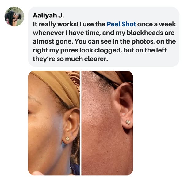 Exfoliating Rice Peel Glowing Serum