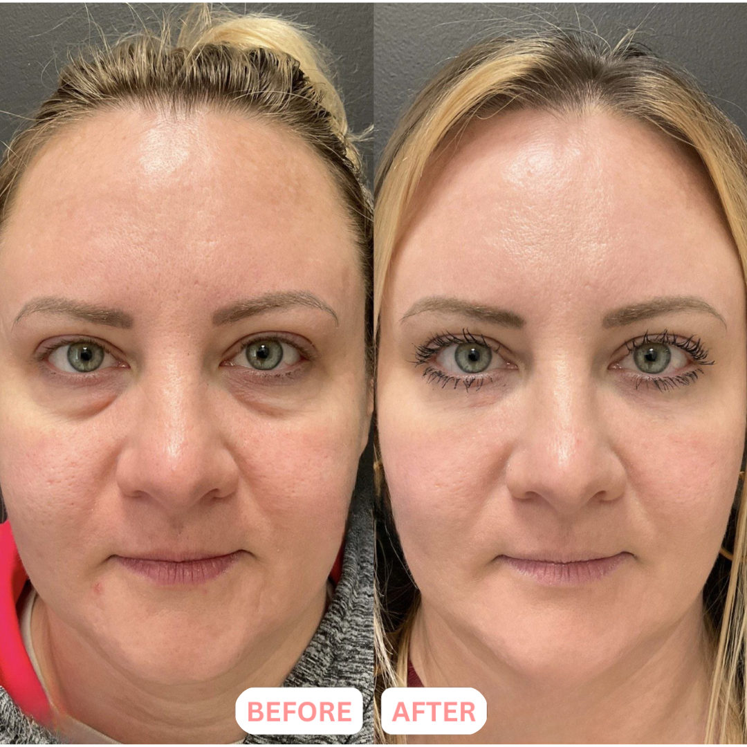 Lymphatic Contour Face Brush™