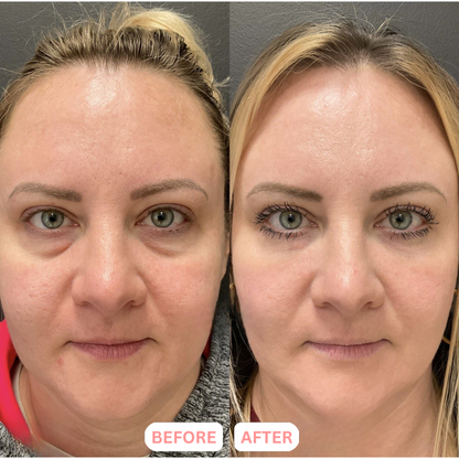 Lymphatic Contour Face Brush™