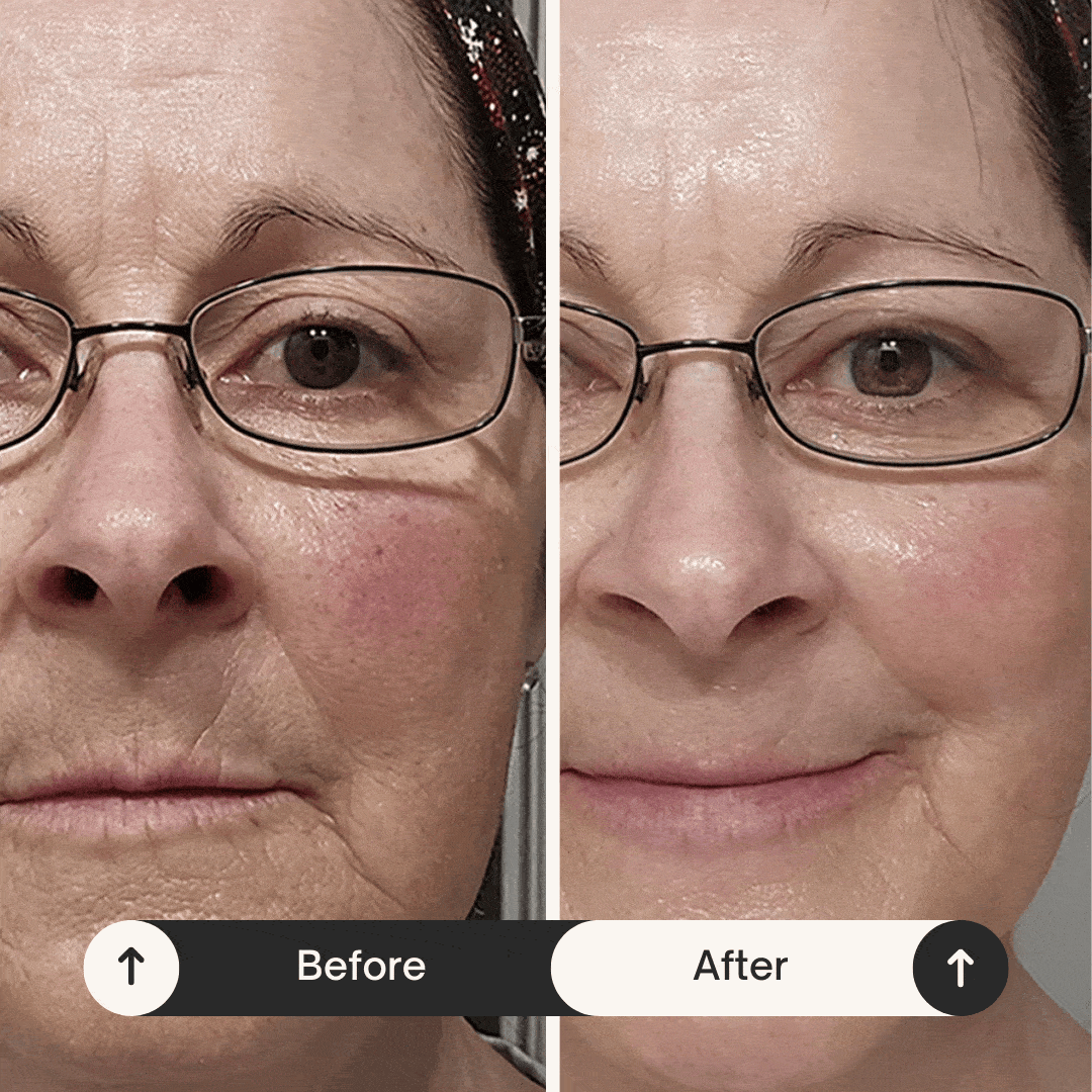 Deep Collagen Rejuvenation Serum | FILLER-LIKE EFFECT