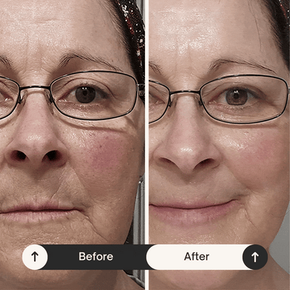 Deep Collagen Rejuvenation Serum | FILLER-LIKE EFFECT