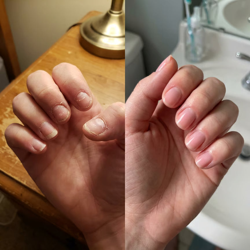 3- Day Nail Care Renewal Formula