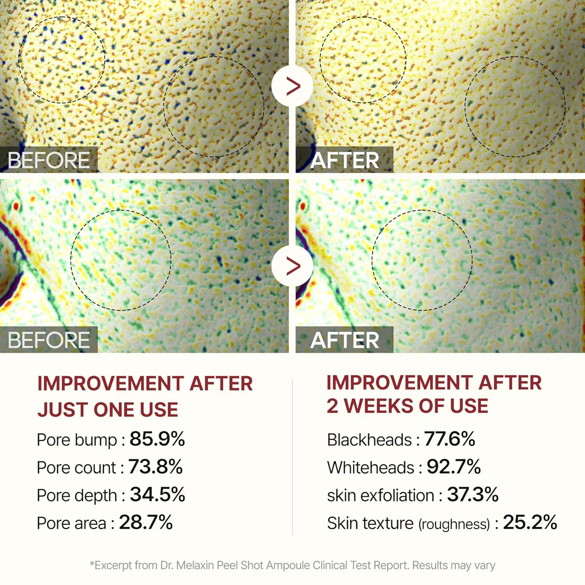 Exfoliating Rice Peel Glowing Serum