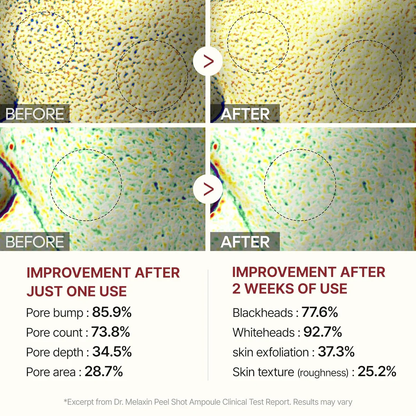 Exfoliating Rice Peel Glowing Serum